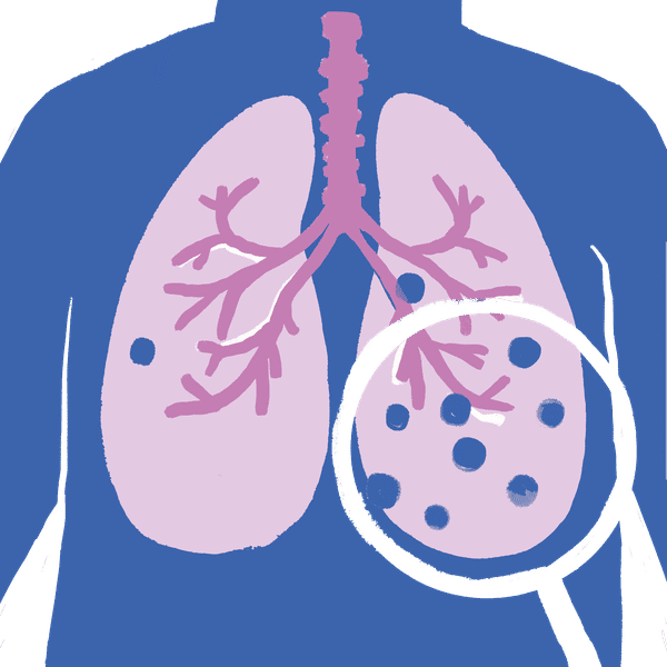 Pneumokokken vaccin Anima Research Center